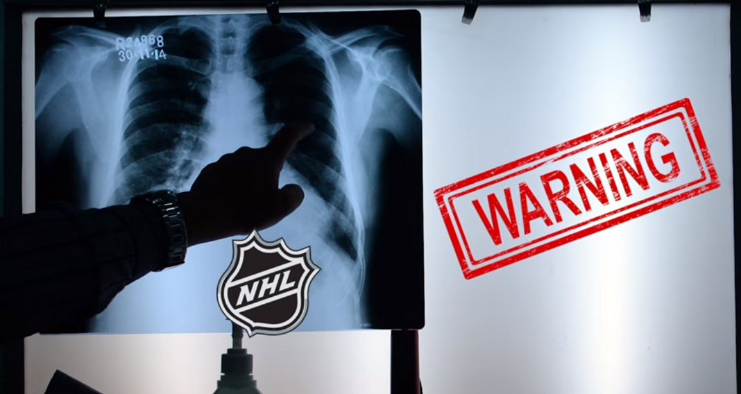Patrzcie jacyśmy fajni, pół składu na noszach – chora mentalność NHL