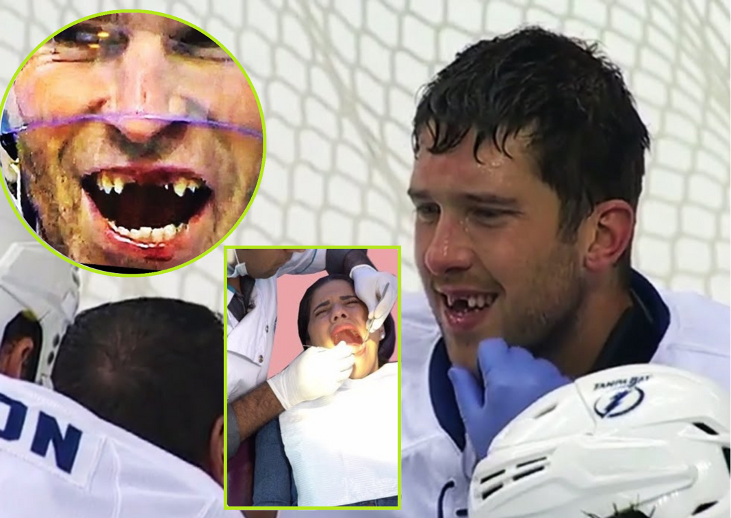 Dentyści w NHL. Ręce pełne roboty i niepełne uśmiechy