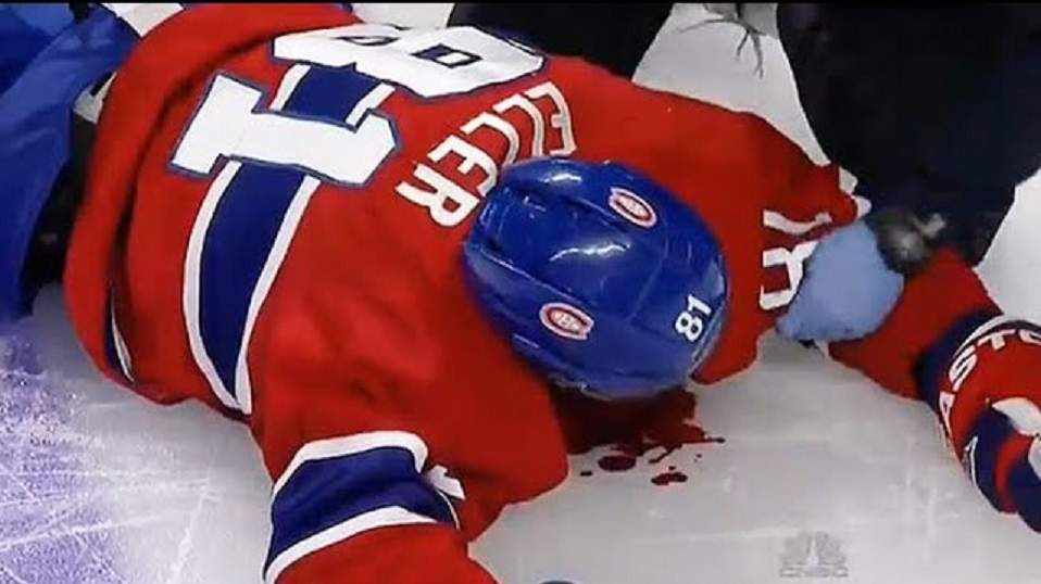 Oto największa zmora NHL. Tak się leczy i walczy z wstrząsami mózgu