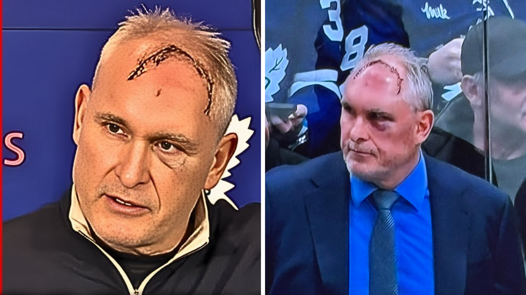 Twarz trenera NHL jest zmasakrowana! Pokazał i wyjawił co się stało. Hokej